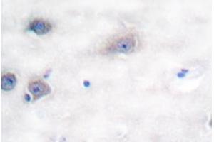Image no. 2 for anti-Tyrosine Hydroxylase (TH) antibody (ABIN271856) (Tyrosine Hydroxylase Antikörper)