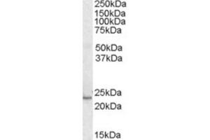 Western Blotting (WB) image for anti-Kruppel-Like Factor 16 (KLF16) (C-Term) antibody (ABIN2465875) (KLF16 Antikörper  (C-Term))