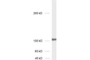 dilution: 1 : 1000; sample: rat hippocampus homogenate (GRIA2 Antikörper  (AA 278-292))