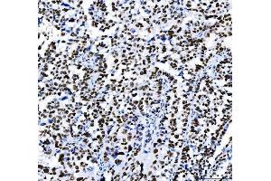 IHC analysis of HDAC2 using anti-HDAC2 antibody (ABIN7601564). (HDAC2 Antikörper  (AA 387-488))