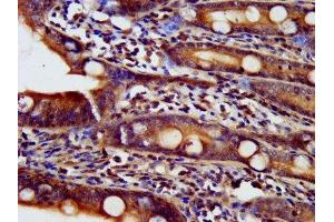 Immunohistochemistry (IHC) image for anti-NADH Dehydrogenase (Ubiquinone) 1 alpha Subcomplex, Assembly Factor 2 (NDUFAF2) (AA 117-169) antibody (ABIN7160878)