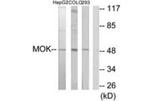 Western blot analysis of extracts from HepG2/COLO205/293 cells, using MOK Antibody. (MOK Antikörper  (AA 261-310))