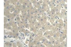 Detection of VF in Human Liver Tissue using Polyclonal Antibody to Visfatin (VF)