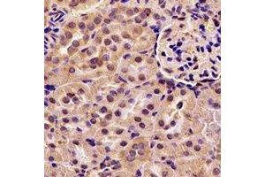 Immunohistochemical analysis of ACAA1 staining in rat kidney formalin fixed paraffin embedded tissue section.
