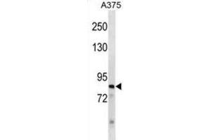 Western Blotting (WB) image for anti-Zinc Finger Protein 148 (ZNF148) antibody (ABIN3000952) (ZNF148 Antikörper)