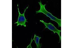 Immunofluorescence analysis of LOVO cells using Rab10 antibody (green). (RAB10 Antikörper)