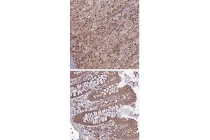 Immunohistochemical staining of human colon with TIGD7 polyclonal antibody  shows moderate cytoplasmic positivity in glandular cells.