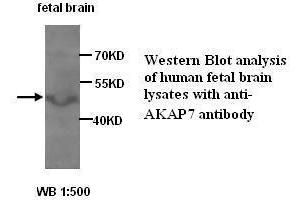 Image no. 1 for anti-A Kinase (PRKA) Anchor Protein 7 (AKAP7) antibody (ABIN1574566) (AKAP7 Antikörper)
