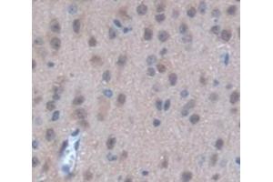 Used in DAB staining on fromalin fixed paraffin- embedded Kidney tissue (STK3 Antikörper  (AA 235-460))