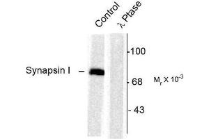 Image no. 1 for anti-Synapsin I (SYN1) (pSer603) antibody (ABIN372721) (SYN1 Antikörper  (pSer603))