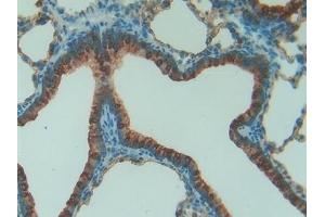 Detection of SFTPA1 in Rat Lung Tissue using Polyclonal Antibody to Pulmonary Surfactant Associated Protein A1 (SFTPA1) (Surfactant Protein A1 Antikörper  (AA 21-248))