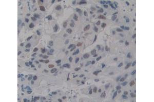 Used in DAB staining on fromalin fixed paraffin- embedded breast tissue (TDP1 Antikörper  (AA 4-215))