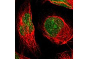 Immunofluorescent staining of U-2 OS with MINA polyclonal antibody  (Green) shows positivity in nucleus and nucleoli.
