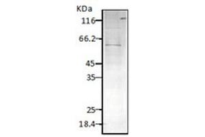 Western blot analysis of Parasite Lysates showing detection of HSP60 protein using Rabbit Anti-HSP60 Polyclonal Antibody . (HSPD1 Antikörper  (FITC))