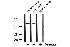 Western blot analysis of extracts from mouse lung, rat brain, using M-CK Antibody. (CKM Antikörper  (N-Term))