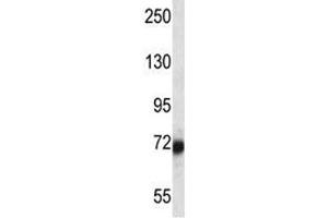 SP100 antibody western blot analysis in ZR-75-1 lysate. (SP100 Antikörper  (AA 199-227))
