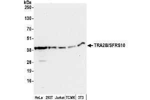 anti-Transformer 2 beta Homolog (TRA2B) (AA 1-50) antibody