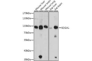 Western blot analysis of extracts of various cell lines, using SOG antibody (6597) at 1:1000 dilution. (SOGA1 Antikörper  (AA 650-750))