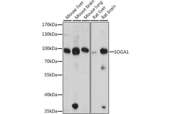 SOGA1 Antikörper  (AA 650-750)