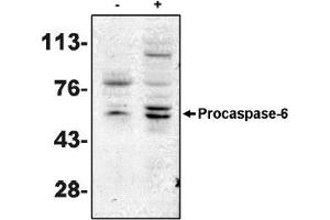 Western Blotting (WB) image for anti-Caspase 6, Apoptosis-Related Cysteine Peptidase (CASP6) antibody (ABIN264405) (Caspase 6 Antikörper)