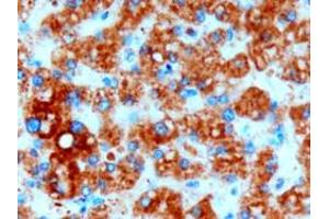 Immunohistochemistry (IHC) image for anti-Diacylglycerol O-Acyltransferase 2 (DGAT2) (Internal Region) antibody (ABIN190849)