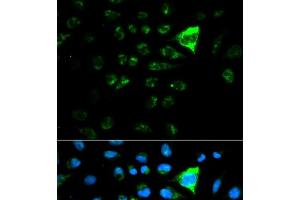 Immunofluorescence analysis of MCF-7 cells using CDKN1A Polyclonal Antibody (p21 Antikörper)