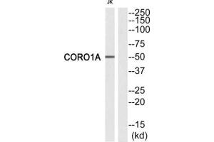Western Blotting (WB) image for anti-Coronin, Actin Binding Protein, 1A (CORO1A) (Internal Region) antibody (ABIN1849308) (Coronin 1a Antikörper  (Internal Region))