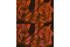 Immunofluorescence analysis of U-2 OS cells using PFKM Rabbit pAb (ABIN6132211, ABIN6145488, ABIN6145489 and ABIN6221141) at dilution of 1:100 (40x lens). (PFKM Antikörper  (AA 501-780))