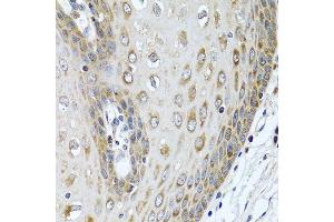Immunohistochemistry of paraffin-embedded human esophagus using LRG1 antibody at dilution of 1:100 (40x lens).