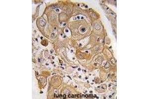 Immunohistochemistry (IHC) image for anti-Polymerase I and Transcript Release Factor (PTRF) antibody (ABIN3003202)