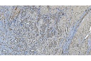 IHC analysis of GRX2/GLRX2 using anti-GRX2/GLRX2 antibody (ABIN7599022).