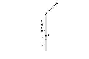 Anti-MLL2 Antibody  at 1:80000 dilution + recombinant protein whole cell lysate Lysates/proteins at 20 μg per lane. (MLL2 Antikörper  (C-Term))