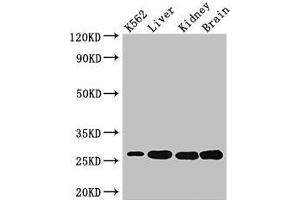 Western Blot Positive WB detected in: K562 whole cell lysate, Mouse liver tissue, Mouse kidney tissue, Mouse brain tissue All lanes: QDPR antibody at 3 μg/mL Secondary Goat polyclonal to rabbit IgG at 1/50000 dilution Predicted band size: 26, 23 kDa Observed band size: 26 kDa (QDPR Antikörper  (AA 2-244))