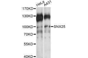 Western blot analysis of extracts of various cell lines, using SNX25 antibody (ABIN6291213) at 1:1000 dilution. (SNX25 Antikörper)