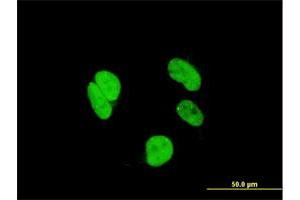 Immunofluorescence of monoclonal antibody to RAX on HeLa cell. (RAX Antikörper  (AA 104-206))