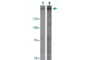 Western blot analysis of CHD7 in SK-N-SH cell lysate with CHD7 polyclonal antibody  at (lane 1) 1 and (lane 2) 2 ug/mL.