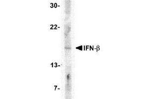 Western blot analysis of IFN-b in A-20 cell lysate with AP30401PU-N IFN-b antibody at 5 μg/ml. (IFNB1 Antikörper  (Center))