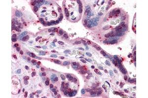 Immunohistochemistry (IHC) image for anti-Protein Kinase, CGMP-Dependent, Type I (PRKG1) (AA 73-171) antibody (ABIN574323)