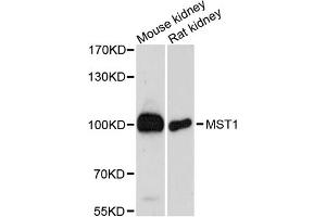 Western blot analysis of extracts of various cell lines, using MST1 antibody (ABIN6293379) at 1:3000 dilution.