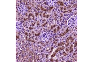 IHC testing of FFPE rat kidney tissue with PDGFRB antibody at 2 ug/ml. (PDGFRB Antikörper  (AA 911-992))
