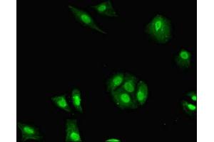 Immunofluorescent analysis of MCF-7 cells using ABIN7155373 at dilution of 1:100 and Alexa Fluor 488-congugated AffiniPure Goat Anti-Rabbit IgG(H+L) (H2AFB1 Antikörper  (AA 1-115))