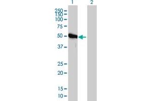 Western Blot analysis of GART expression in transfected 293T cell line by GART monoclonal antibody (M01), clone 4D6-1D5. (GART Antikörper  (AA 1-433))