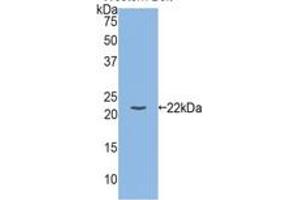 Western Blotting (WB) image for Interleukin 1, beta (IL1B) ELISA Kit (ABIN6574166)