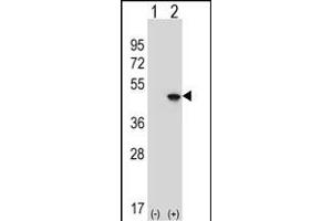 Western Blotting (WB) image for anti-Eukaryotic Translation Initiation Factor 4A2 (EIF4A2) (AA 333-360), (C-Term) antibody (ABIN653137)