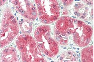 ABIN238652 (5µg/ml) staining of paraffin embedded Human Kidney. (BDH2 Antikörper  (Internal Region))