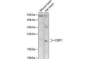 Western blot analysis of extracts of various cell lines, using CDIP1 antibody (ABIN7268288) at 1:1000 dilution. (CDIP1 Antikörper  (AA 100-200))