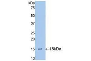 Detection of Recombinant IL15, Mouse using Polyclonal Antibody to Interleukin 15 (IL15) (IL-15 Antikörper  (AA 49-162))