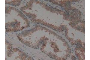 IHC-P analysis of Human Prostate Gland Tissue, with DAB staining. (CX3CL1 Antikörper  (AA 25-332))