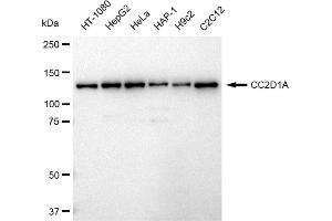 Western blotting analysis using CC2D1A antibody (ABIN7798112). (Rekombinanter CC2D1A Antikörper)