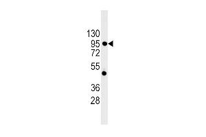 Western Blotting (WB) image for anti-Cadherin 1, Type 1, E-Cadherin (Epithelial) (CDH1) (AA 160-189), (N-Term) antibody (ABIN5534948)